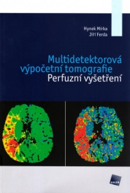 MULTIDETEKTOROV&Aacute; V&Yacute;POČETN&Iacute; TOMOGRAFIE. PERFUZN&Iacute; VY&Scaron;ETŘEN&Iacute;