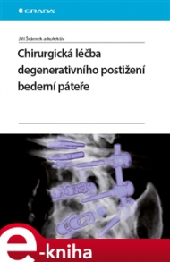 CHIRURGICK&Aacute; L&Eacute;ČBA DEGENERATIVN&Iacute;HO POSTIŽEN&Iacute; BEDERN&Iacute;  P&Aacute;TEŘE