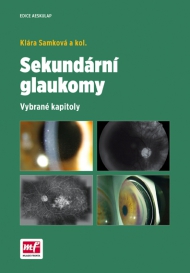 SEKUND&Aacute;RN&Iacute; GLAUKOMY