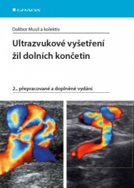 Ultrazvukov&eacute; vy&scaron;etřen&iacute; žil doln&iacute;ch končetin 2., přepracovan&eacute; a doplněn&eacute; vyd&aacute;n&iacute;