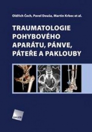 Traumatologie pohybov&eacute;ho &uacute;stroj&iacute;, p&aacute;nve, p&aacute;teře a paklouby