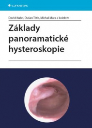 Z&aacute;klady panoramatick&eacute; hysteroskopie