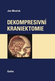 Dekompresivn&iacute; kraniektomie