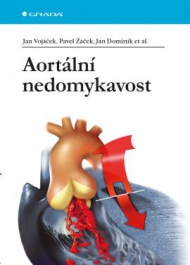 Aort&aacute;ln&iacute; nedomykavost