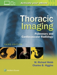 Thoracic Imaging Pulmonary and Cardiovascular Radiology, 3rd edition