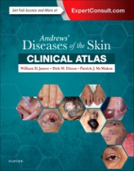 Andrews' Diseases of the Skin Clinical Atlas (e-book)