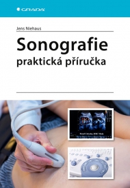 Sonografie - praktick&aacute; př&iacute;ručka