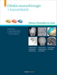 Dětsk&aacute; neurochirurgie v kazuistik&aacute;ch
