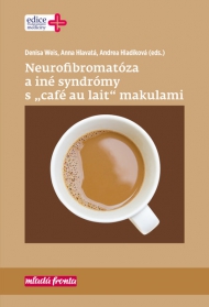 Neurofibromat&oacute;za a in&eacute; syndr&oacute;my s &bdquo;caf&eacute; au lait&ldquo; makulami