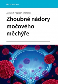 Zhoubn&eacute; n&aacute;dory močov&eacute;ho měch&yacute;ře