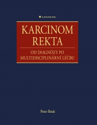 Karcinom rekta, od diagn&oacute;zy po multidisciplin&aacute;rn&iacute; l&eacute;čbu