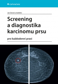 Screening a diagnostika karcinomu prsu pro každodenn&iacute; praxi