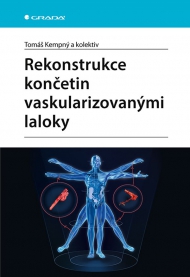 Rekonstrukce končetin vaskularizovan&yacute;mi laloky