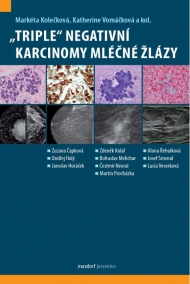 &bdquo;Triple&ldquo; negativn&iacute; karcinomy ml&eacute;čn&eacute; žl&aacute;zy