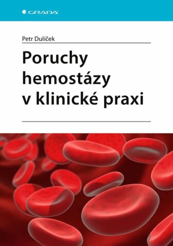 Poruchy hemost&aacute;zy v klinick&eacute; praxi
