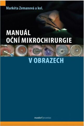 Manu&aacute;l očn&iacute; mikrochirurgie v obrazech