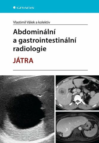 Abdomin&aacute;ln&iacute; a gastrointestin&aacute;ln&iacute; radiologie, J&Aacute;TRA