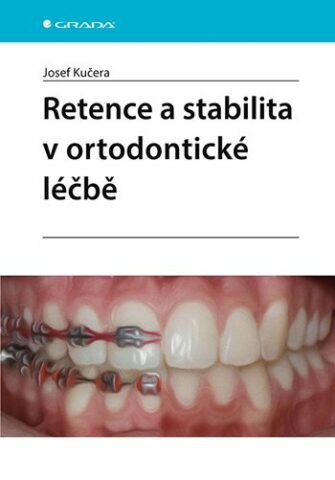 Retence a stabilita v ortodontick&eacute; l&eacute;čbě