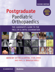 Postgraduate Paediatic Orthopaedics, 2nd Edition