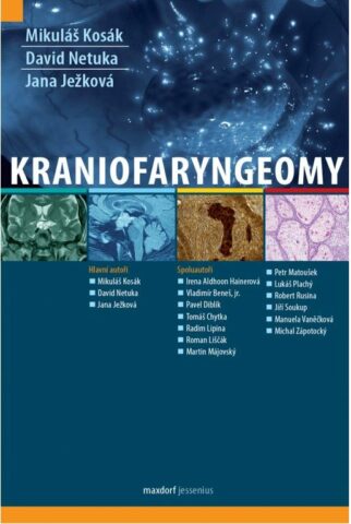 Kraniofaryngeomy