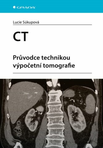 CT - Průvodce technikou v&yacute;početn&iacute; tomografie