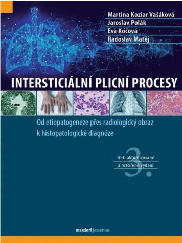 Interstici&aacute;ln&iacute; plicn&iacute; procesy