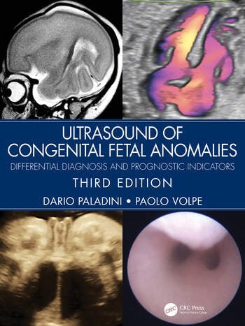 Ultrasound of Congenital Fetal Anomalies Differential Diagnosis and Prognostic Indicators, 3rd Edion