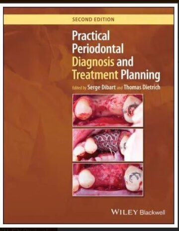 Practical Periodontal Diagnosis and Treatment Planning, 2nd Edition