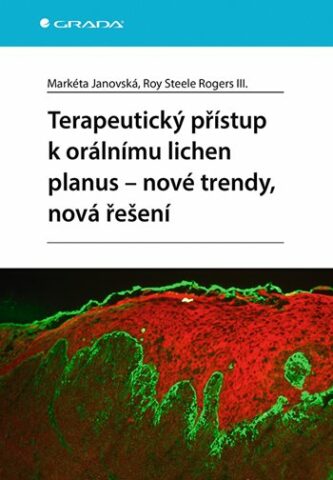 Terapeutick&yacute; př&iacute;stup k or&aacute;ln&iacute;mu lichen planus - nov&eacute; trendy, nov&aacute; ře&scaron;en&iacute;