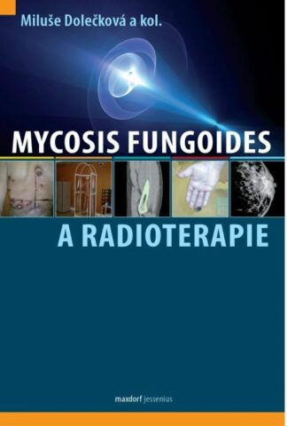 Mycosis fungoides a radioterapie