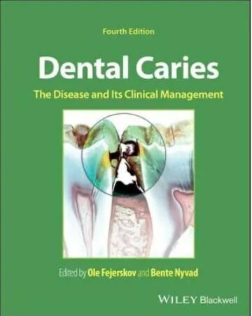 Dental Caries The Disease and Its Clinical Management, Fourth edition