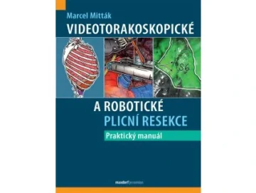 Videotorakoskopick&eacute; a robotick&eacute; plicn&iacute; resekce