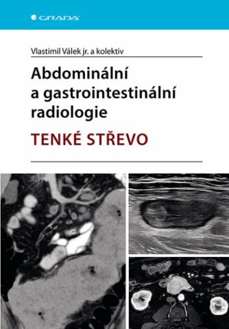 Abdomin&aacute;ln&iacute; a gastrointestin&aacute;ln&iacute; radiologie TENK&Eacute; STŘEVO