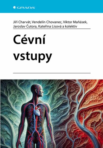 C&eacute;vn&iacute; vstupy