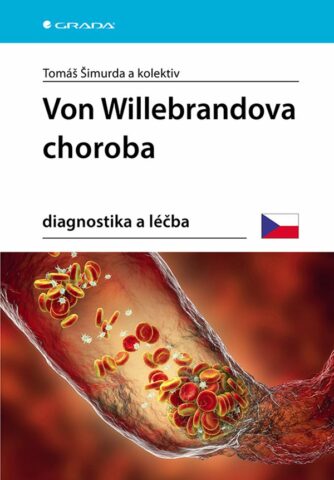 Von Willebrandova choroba, Diagnostika a léčba